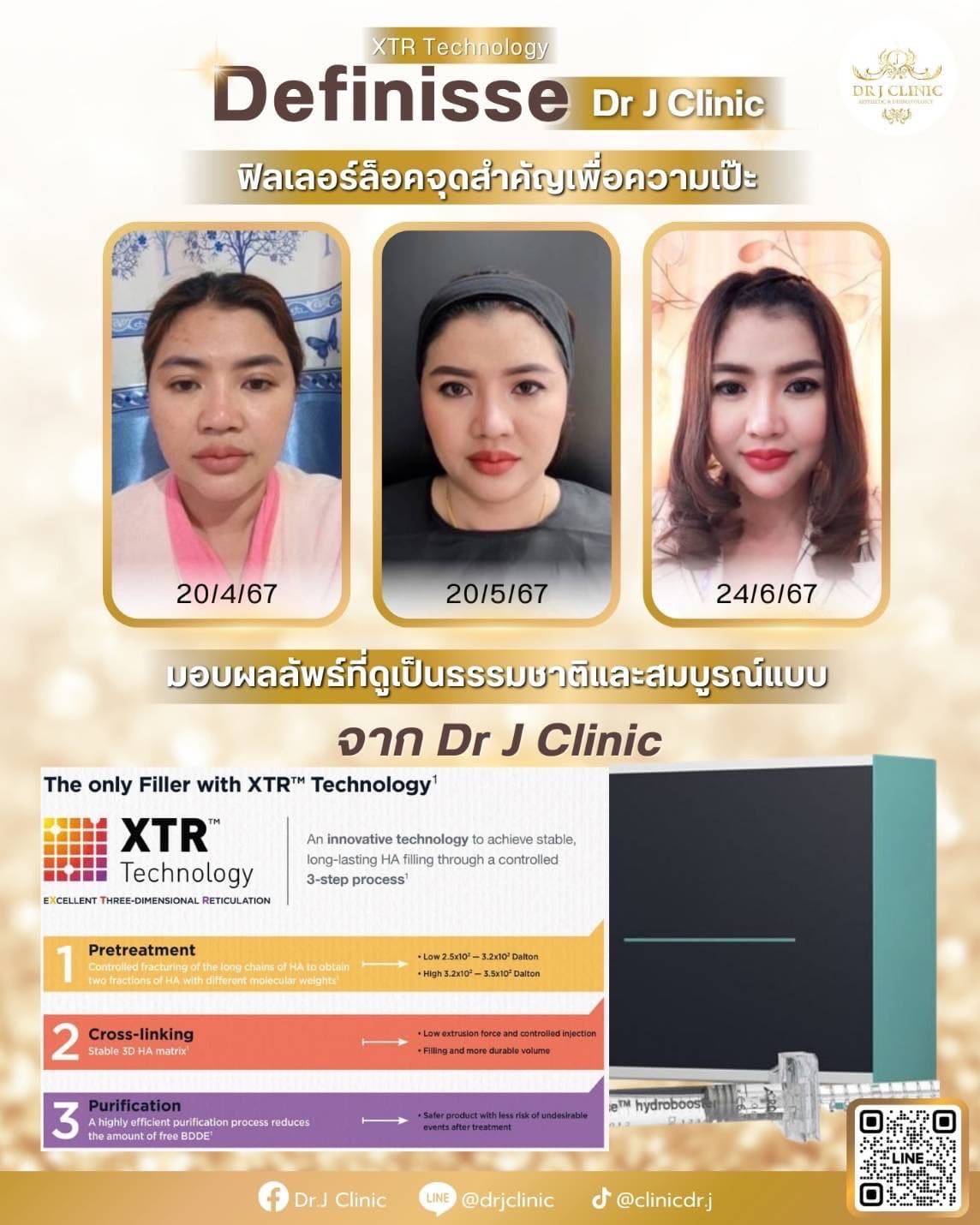 โปรโมชั่น Definisse Hydrobooster ที่ Dr. J Clinic – เทคโนโลยี XTR เติมความชุ่มชื้นให้ผิว ลดรูขุมขน กระชับผิว เรียบเนียน อิ่มน้ำ ดูสดใส พิเศษ 18,900 บาท แถมฟรี BO Lifting มูลค่า 5,000 บาท
